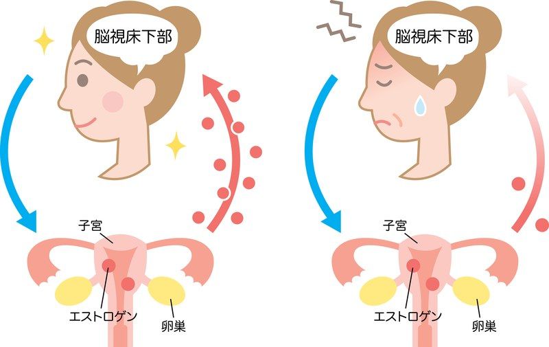脳視床下部と卵巣（エストロゲン）の分泌メカニズム比較イラスト。左側の正常な女性ホルモン分泌サイクルに対し、右側のエストロゲン分泌低下により脳視床下部が混乱・ストレスを受ける様子（更年期症状の仕組み）を図解
