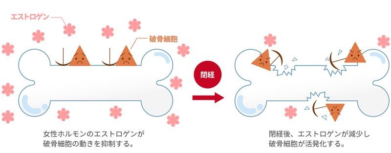 エストロゲンと破骨細胞（骨粗しょう症）のメカニズム比較イラスト。閉経前にエストロゲンが破骨細胞の働きを抑制して骨を守る状態と、閉経後にエストロゲンが減少して破骨細胞が活発化し骨を破壊する様子を図解